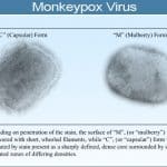 monkey pox