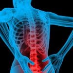 Four 'critical' causes of back pain