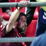 Bayern Munich fans injured in clashes at youth game in Athens