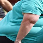 COVID-19: Fat people have higher risk of complications