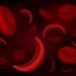 27471673 - red blood cells of sickle cell anaemia disease