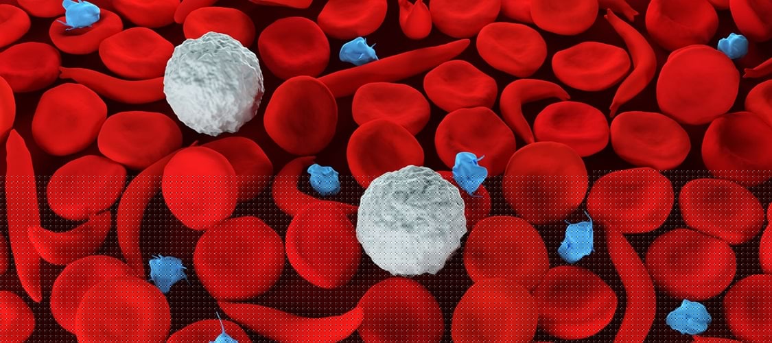 Towards reducing sickle cell disease prevalence in Nigeria