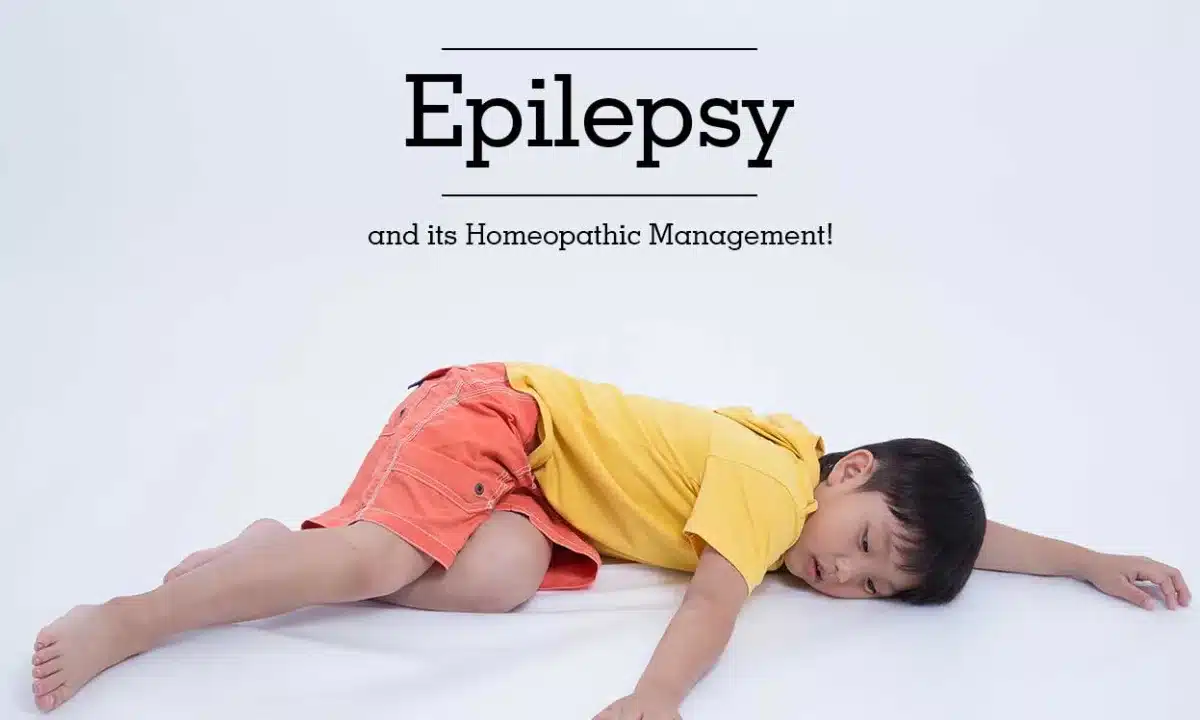 Epilepsy: Expert warns Nigerians against patronizing quacks