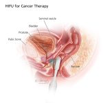 Urological Illustrations by Fairman Studios for American Urological Association patient education materials