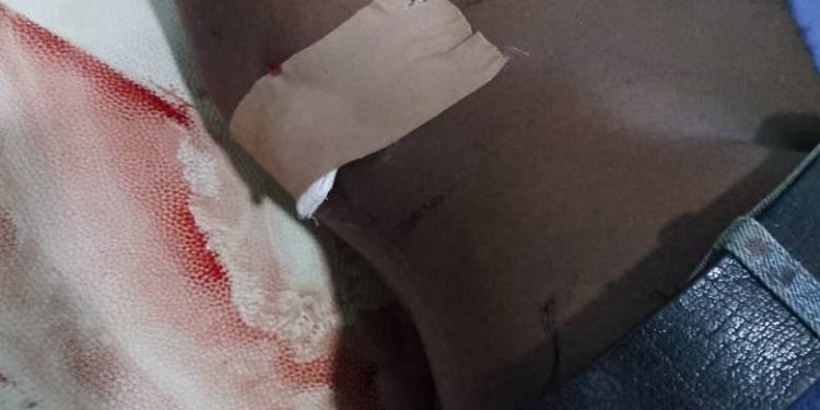 NDLEA officers shot in Abuja