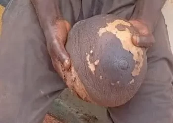 Man arrested with fresh human breast